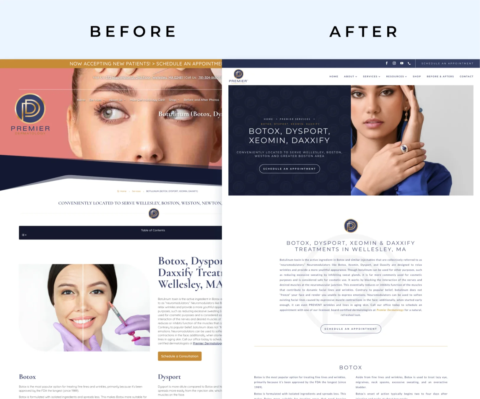 botox page before after premier plastic surgery