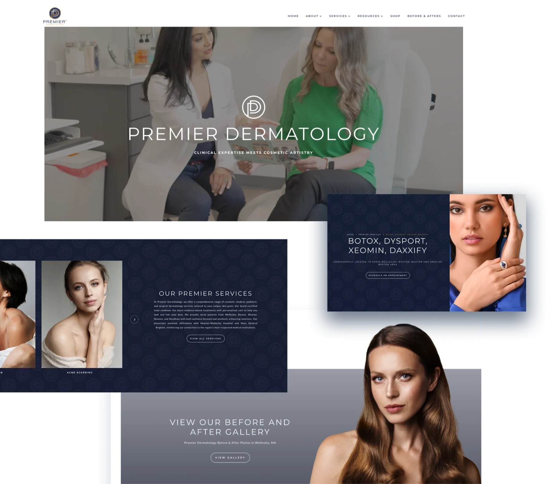 premier plastic surgery redesign compilation